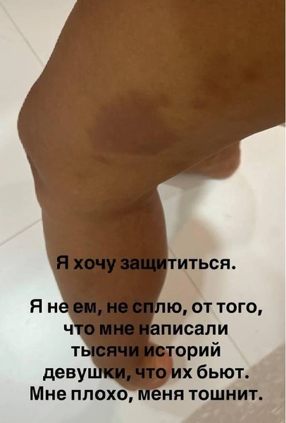 ��������: __angelna.g / Instagram (�������������� �����������, ������������ ��������� �� ���������� ��)