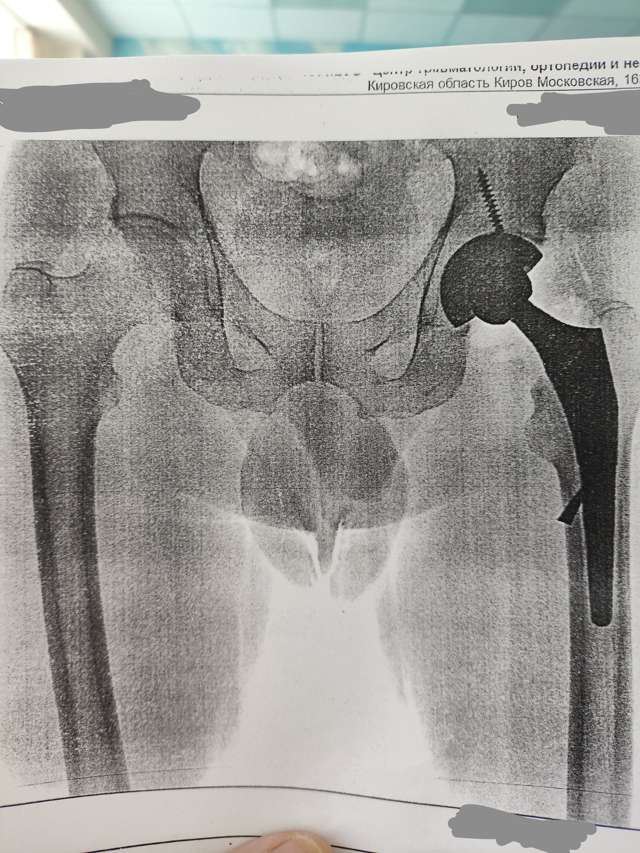 Help, who understands? - My, Operation, Rehabilitation, Help, The medicine, Longpost, No rating