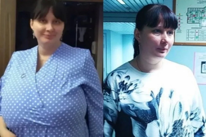 Грудь Екатерины уменьшилась с 22 до 2 размера / Фото предоставлено героиней материала. / Коллаж АиФ